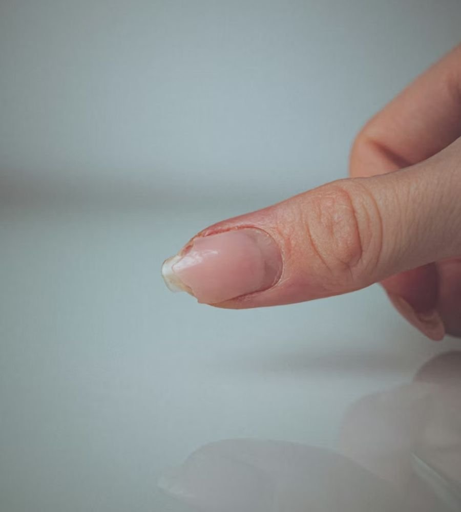 lifted acrylic nails showing damage from skipping acrylic nails refill"
