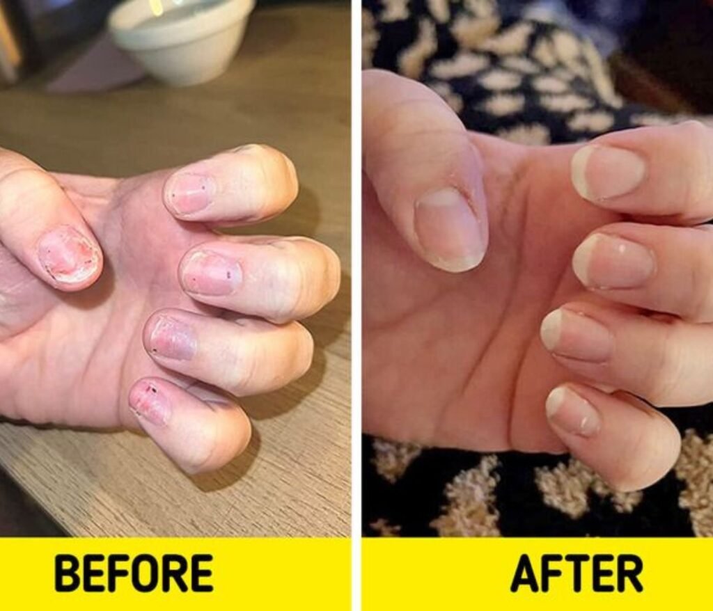 “Common acrylic nail mistakes lifting flooding and over filing examples”