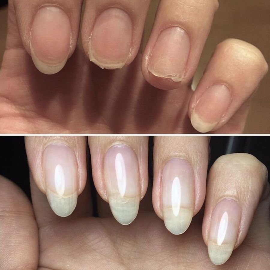 before and after acrylic nails at home transformation