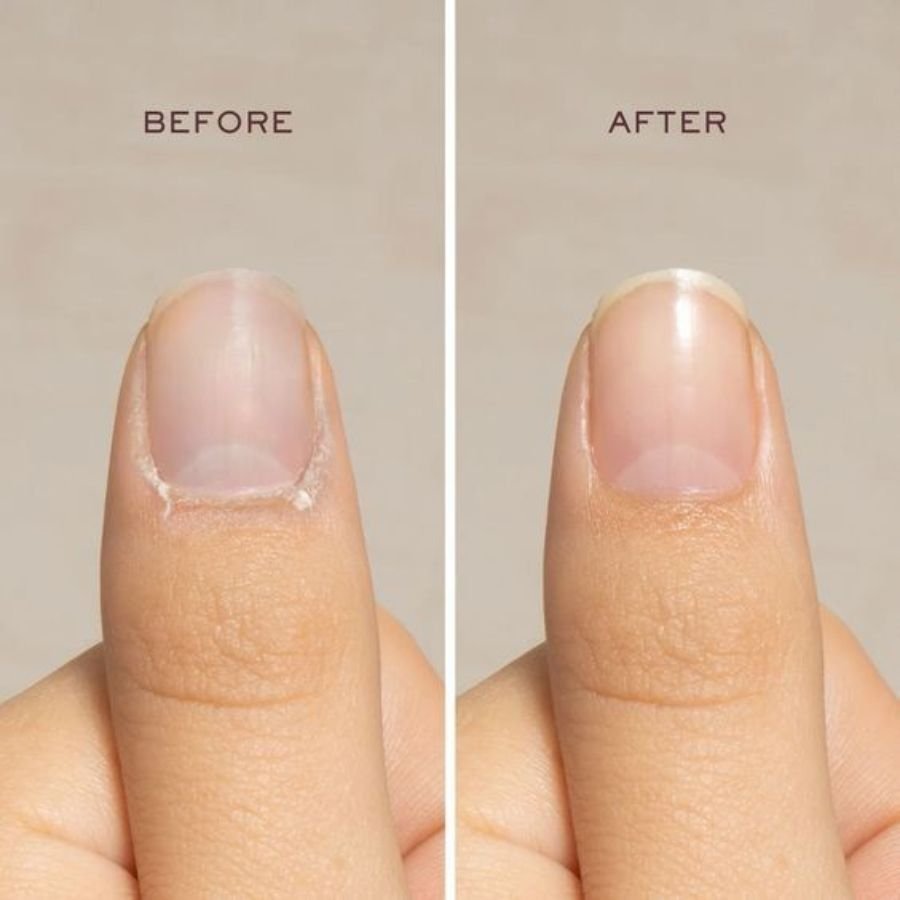 Healthy natural nails after acrylic nails removal with moisturizing cuticle oil