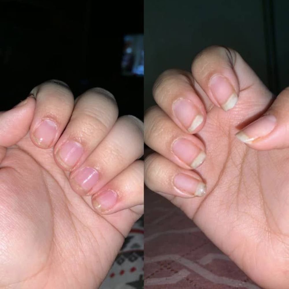 common acrylic nail mistakes to avoid for beginners doing nails at home