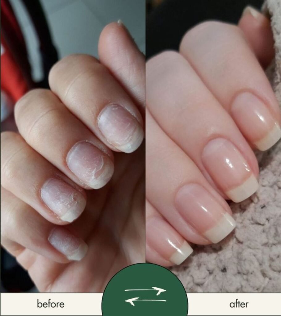 are acrylic nails damaging compared to healthy natural nails